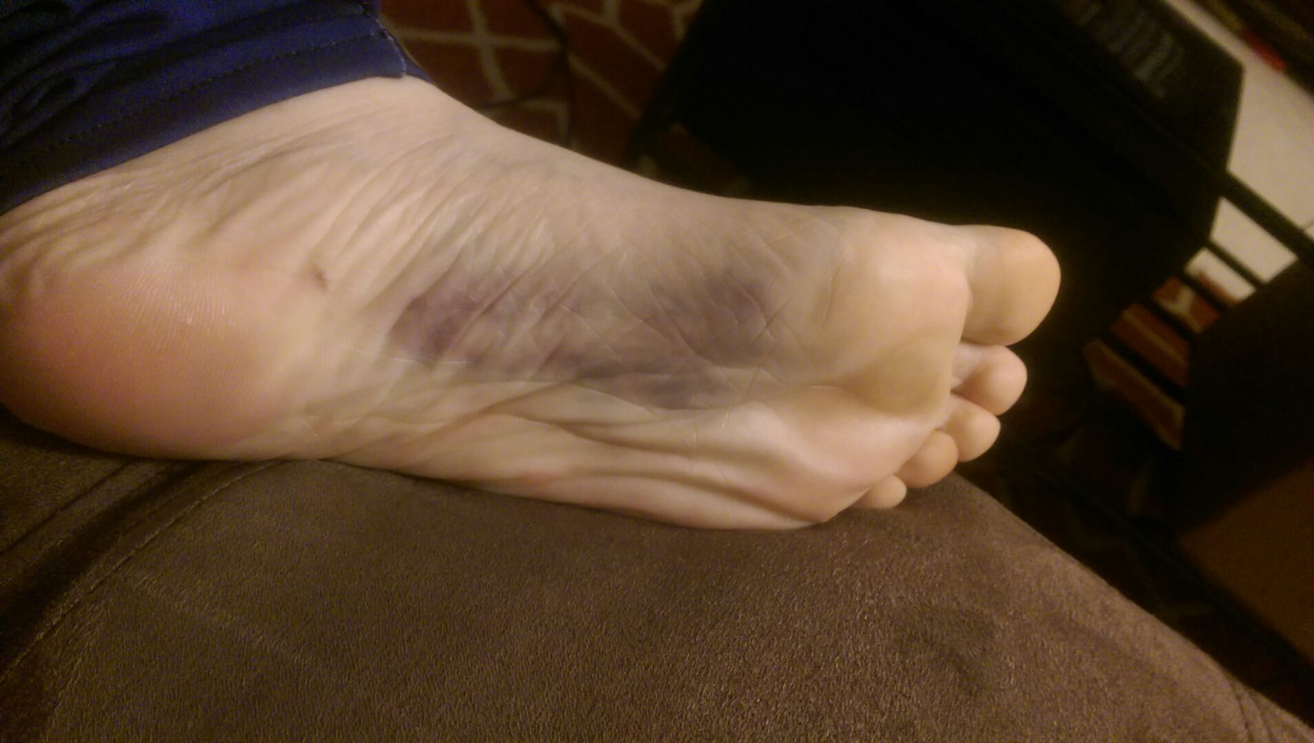 Plantar Fasciitis Massage in Houston, TX